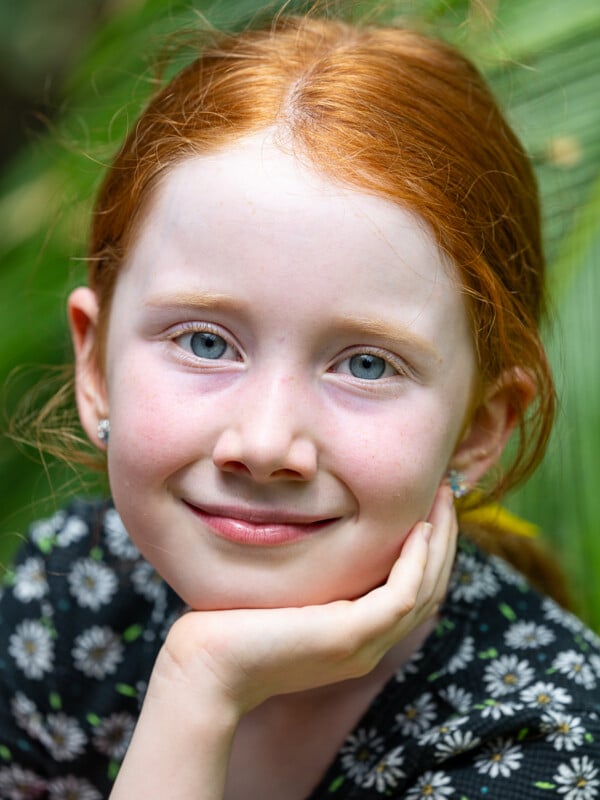 A young girl with red hair, blue eyes, and a fair complexion smiles gently. She is resting her chin on her hand. She is wearing a dress with a floral pattern. The background is blurred with green foliage.